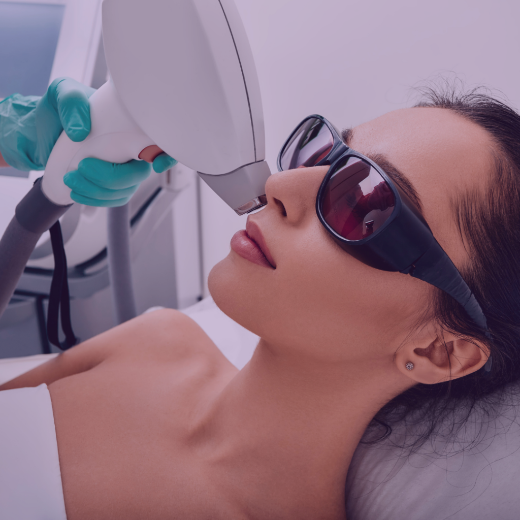 Laser Rejuvenescimento Facial