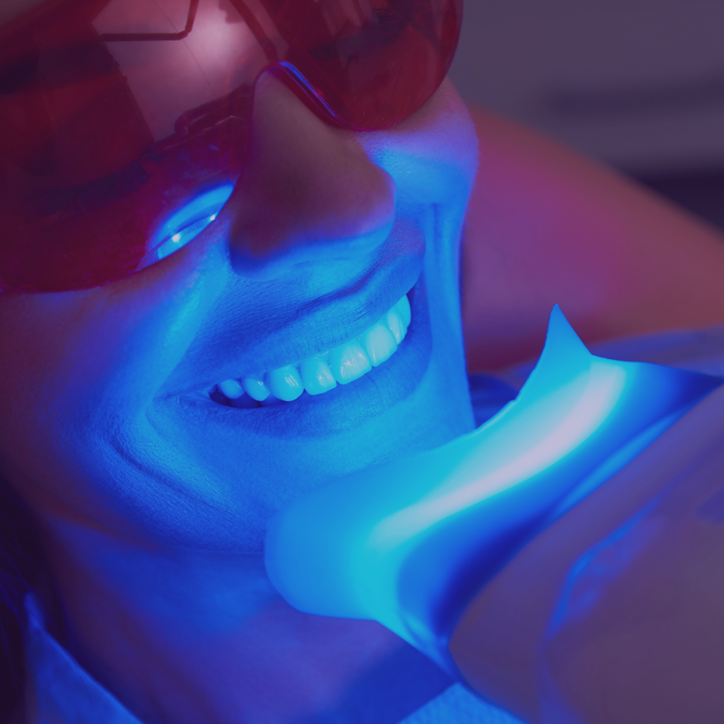 Sessão de Clareamento Dental